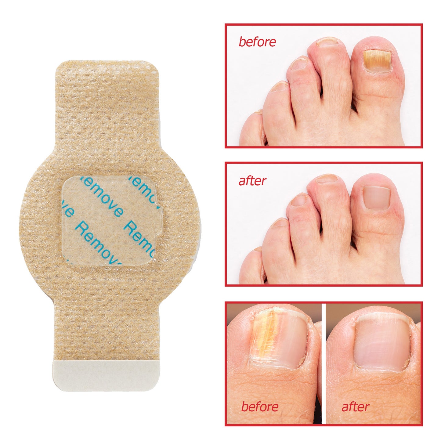 Nail Antibacterial Patch Strengthening Health Patch